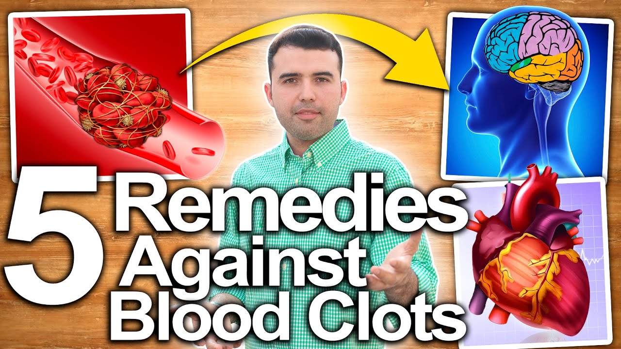 BLOOD CLOT SYMPTOMS AND SOLUTIONs Foods To Improve Circulation And ...